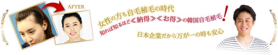 知れば知るほど≪納得≫≪お得≫の韓国自毛植毛