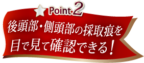 後頭部・側頭部の採取痕を目で見て確認できる!