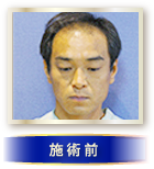 施術前