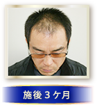 施後3ケ月