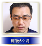 施後6ケ月