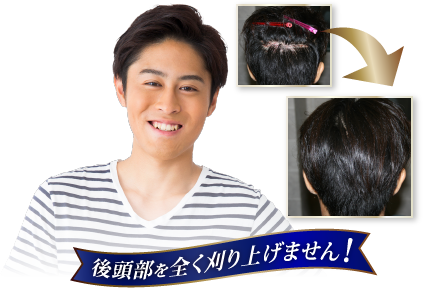 後頭部を全く刈り上げません!