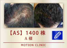 【AS】 1400株
