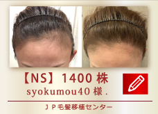 【NS】 1400株
