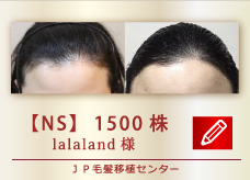 【NS】 1500株