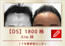 【DS】 1800株