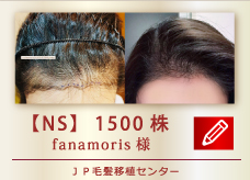 【NS】 1500株
