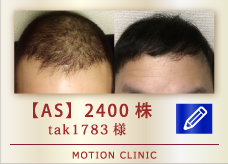 【AS】 2400株