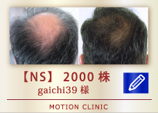 【NS】 2000株