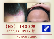 【NS】 1400株