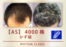 【AS】 4000株