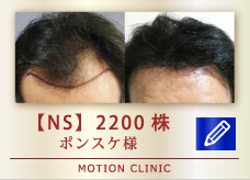 【NS】 2200株