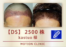【DS】 2500株