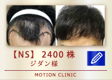 【NS】 2400株