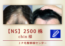 【NS】 2500株