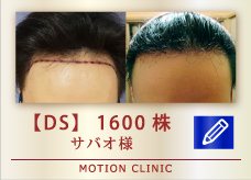 【DS】 1600株