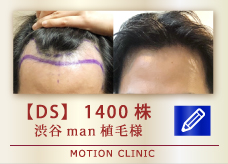 【DS】 1400株