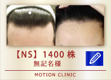 【NS】 1400株