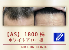 【AS】 1800株