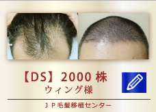 【DS】 2000株