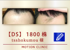 【DS】 1800株